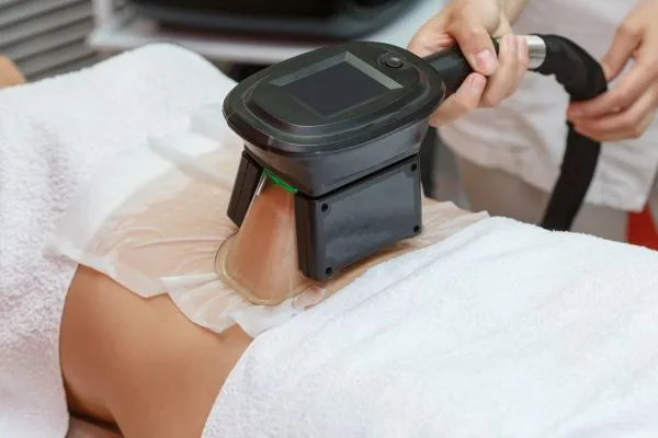 Image of person having fat freezing treatment to help weight gain Wokingham