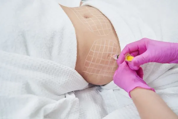 image of fat dissolving injections on love handles to help combat weight gain Wokingham