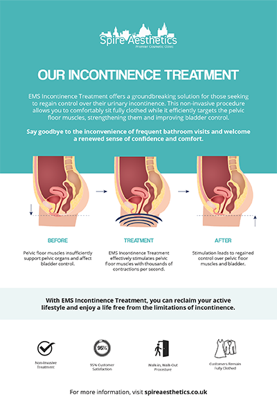 image to show how EMS treatment works for female urinary incontinence Wokingham