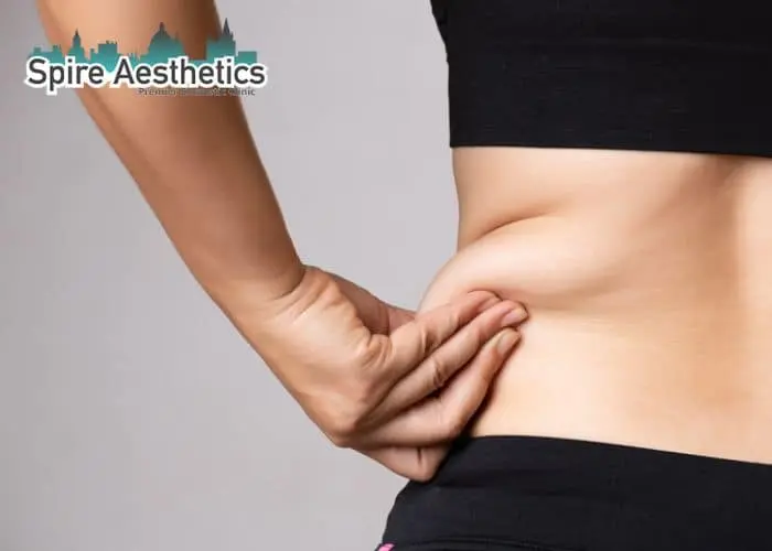 Image of woman pinching fat on their hips Wokingham. Fat Freezing treatment