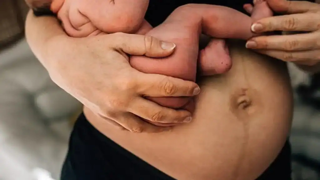 Why Is My Stomach Still Big After Pregnancy Wokingham?